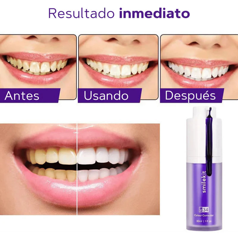 Smilekit v34