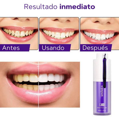 Smilekit v34